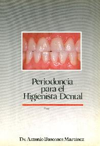 Periodoncia para el higienista dental