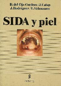 Sida y piel