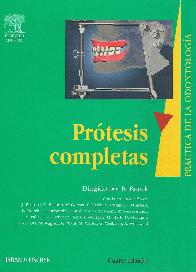 Protesis Completas