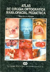 Atlas de cirugia maxilofacial pediatrica