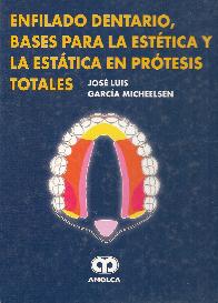 Enfilado Dentario, Bases para la Estatica en Protesis Totales