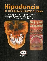Hipodoncia