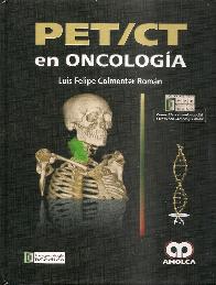 PET / CT en Oncologa