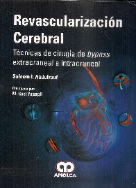 Revascularizacin Cerebral
