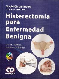 Histerectoma para Enfermedad Benigna