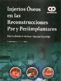 Injertos seos en las Reconstrucciones Pre y Periimplantares