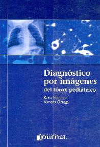 Diagnostico por Imagenes del Torax pediatrico