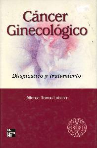 Cancer Ginecologico Diagnostico y Tratamiento