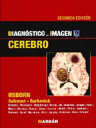 Diagnstico por Imagen Cerebro