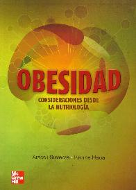Obesidad