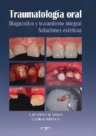 Traumatologa Oral