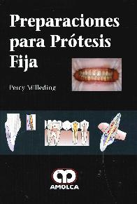 Preparaciones para Prtesis Fija