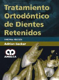 Tratamiento Ortodntico de Dientes Retenidos