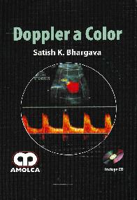 Doppler a Color