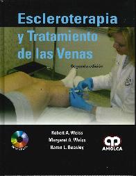 Escleroterapia y Tratamiento de las Venas