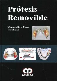 Prtesis Removible