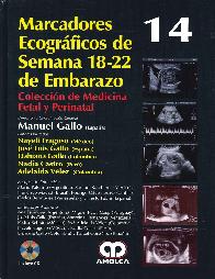 Marcadores Ecogrficos de Semana 18-22 de Embarazo 14