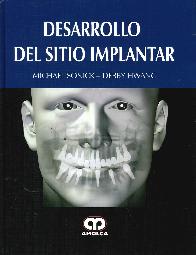 Desarrollo del Sitio Implantar