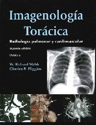 Imagenologa Torcica 2 Tomos