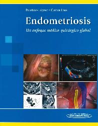 Endometriosis