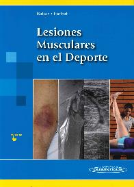 Lesiones Musculares en el Deporte