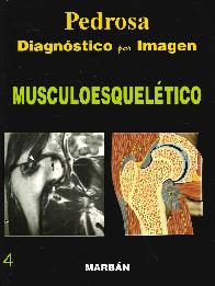 Pedrosa Diagnstico por Imagen Musculoesqueltico 4