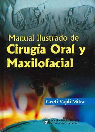 Manual Ilustrado de Ciruga Oral y Maxilofacial