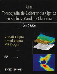 Atlas Tomografa de Coherencia ptica en Aptologa Macular y Glaucoma