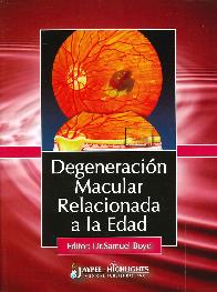 Degeneracin Macular Relacionada a la Edad