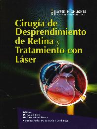 Ciruga de Desprendimiento de Retina y Tratamiento con Lser