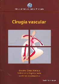 Cirugía Vascular