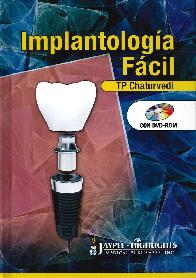 Implantologa Fcil