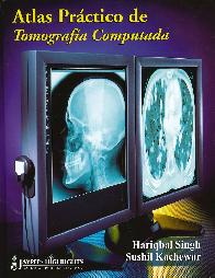 Atlas Prctico de Tomografa Computarizada