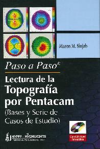 Lectura de la Topografa por Pentacam