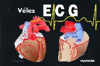 Vlez ECG