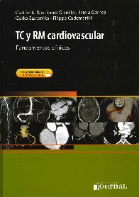 TC y RM Cardiovascular