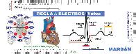Regla de Electros ECG Vlez