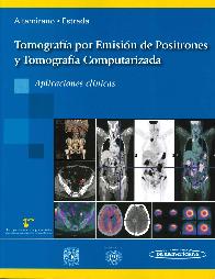 Tomografa por Emisin de Positrones y Tomografa Computarizada