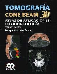 Tomografa Cone Beam 3D