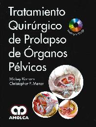 Tratamiento Quirrgico del Prolapso de rganos Plvicos