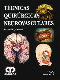 Tcnicas Quirrgicas Neurovasculares