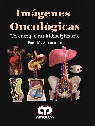 Imgenes Oncolgicas