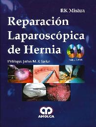 Reparacin Laparoscpica de Hernia