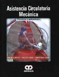 Asistencia Circulatoria Mecnica