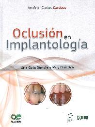Oclusin en Implantologa