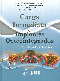 Carga Inmediata e Implantes Osteointegrados