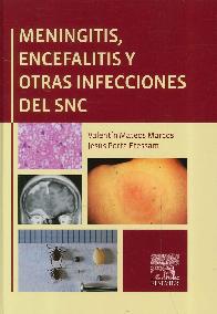 Meningitis, Encefalitis y Otras Infecciones del SNC