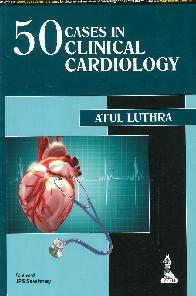 50 Cases in clinical cardiology