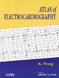 Atlas of Electrocardiography