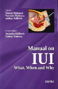 Manual on IUI What, When and Why